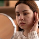 Mengapa Muncul Flek Hitam Saat Hamil? Ketahui Penyebab dan Cara Mencegahnya agar Tidak Lebih Parah